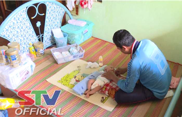 Hoàn cảnh bé trai không có hậu môn ở huyện Kế Sách