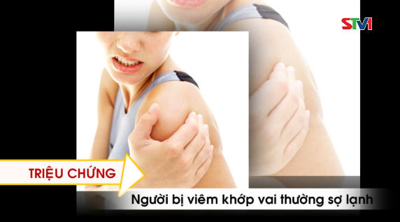 Nhịp cầu y tế - Nhận biết và điều trị bệnh viêm quanh khớp vai 17-08-2016