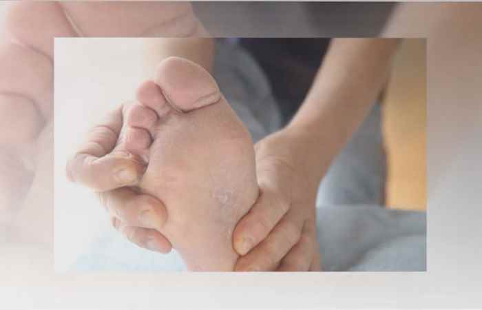 Sống khỏe 360 - Nấm da chân có trị dứt điểm được không (04-09-2020)