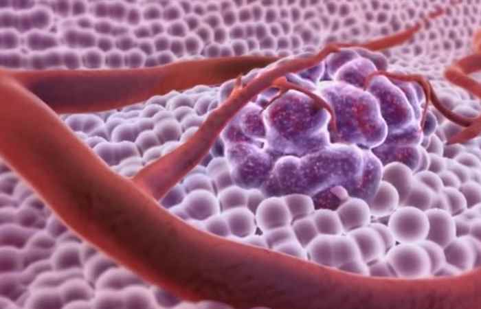 Sống khỏe 360 (12-09-2019)