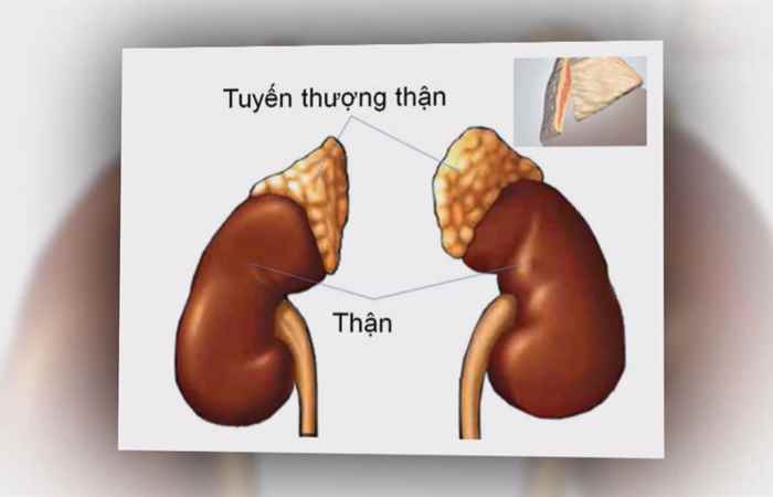 Sống khỏe 360 - U tuyến thượng thận có phải mổ không? (27-12-2019)