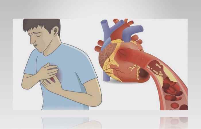 Sống khỏe 360 Biến chứng nguy hiểm khi hạ kali máu (29-01-2021)