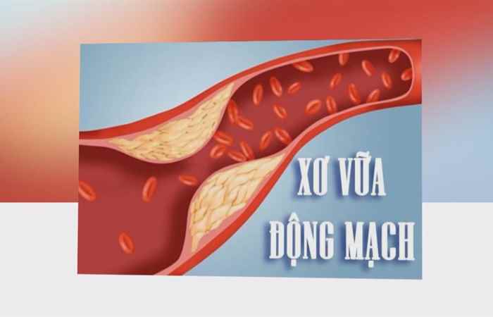 Sống khỏe 360 - Bệnh máu nhiễm mở ở trẻ em 01-01-2020