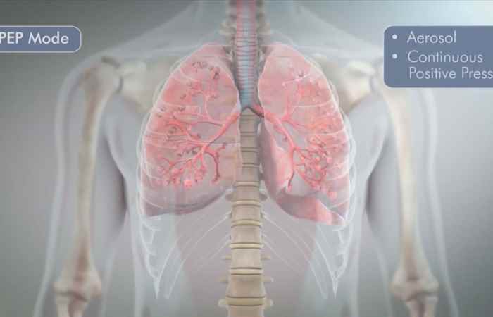 Sống khỏe 360 - Bệnh viêm phổi cộng đồng (09-07-2020)