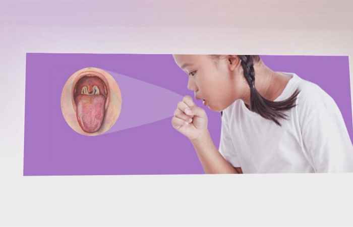 Sống khỏe 360 - Dấu hiệu bệnh bạch hầu có dễ nhận biết? (07-09-2020)