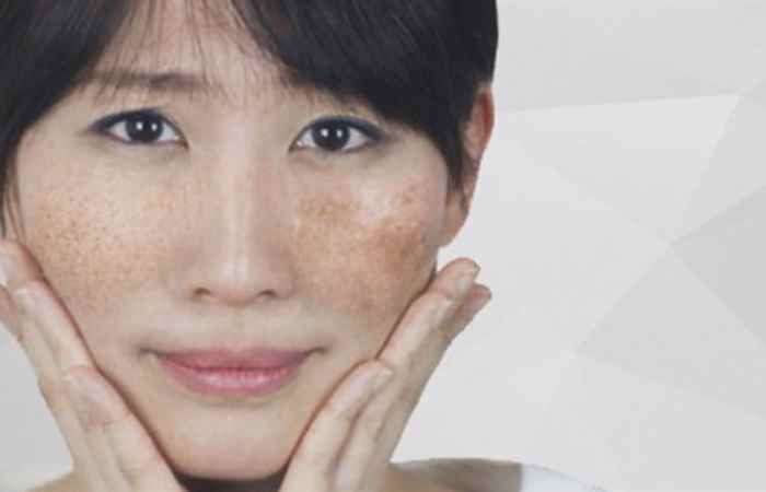 Sống khỏe 360 - Nám và thực hư những lời quảng cáo (30-08-2020)