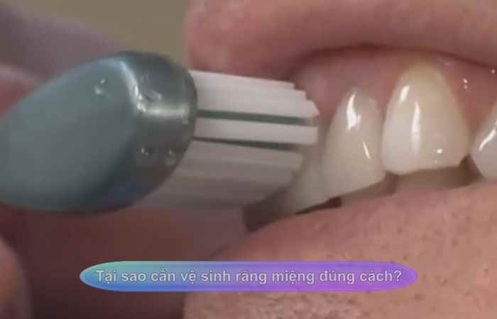 Sống khỏe 360 - Tại sao cần vệ sinh răng miệng đúng cách (13-12-2020)