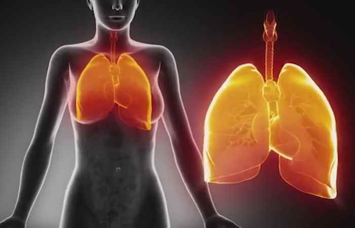 Sống khỏe 360 Thời tiết thay đổi coi chừng viêm phổi 03-02-2019