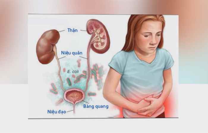 Sống khỏe 360 - Triệu chứng của bệnh Viêm niệu đạo (28-05-2020)