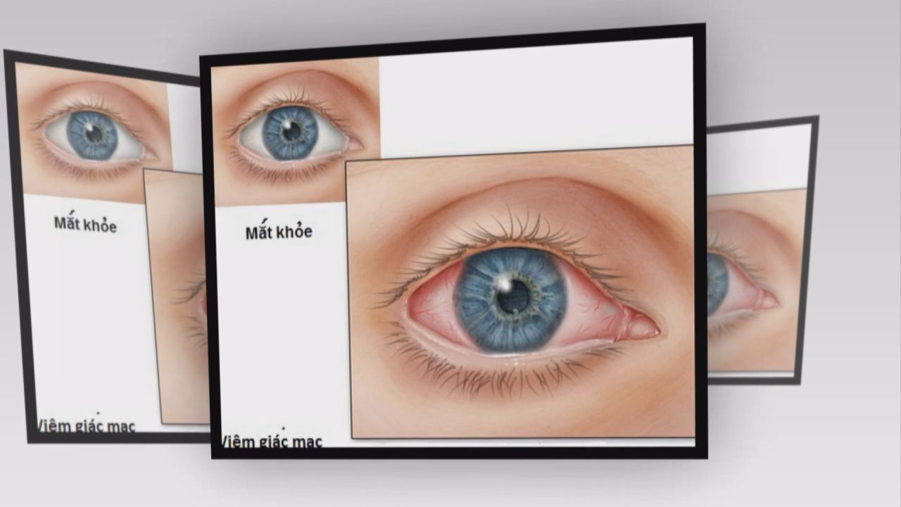 Nhịp cầu y tế 16-11-2016