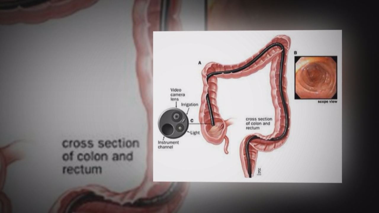 Nhịp cầu y tế - Chế độ ăn cho bệnh nhân bị loãng xương 27-11-2016