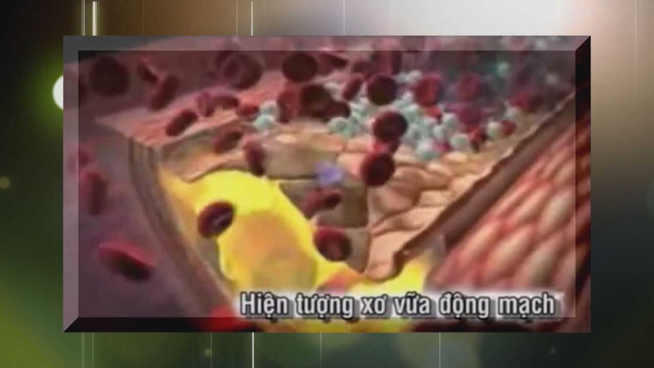 Nhịp cầu y tế 28-11-2016