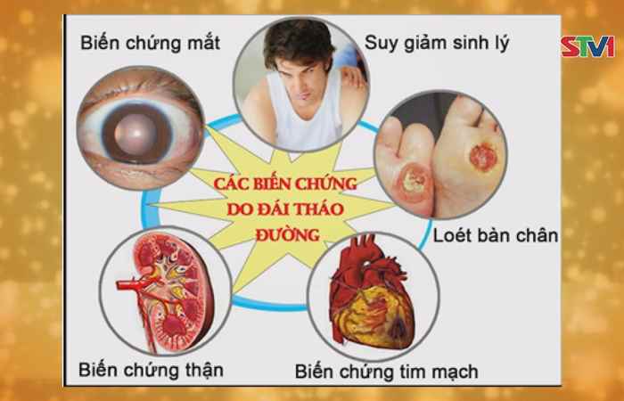 Sức khỏe cho mọi người 04-11-2017