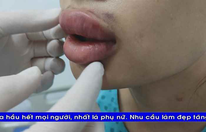  Thời sự tiếng Khmer (03-01-2023)