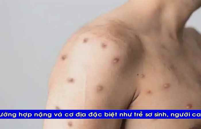 Thời sự tiếng Khmer (30-07-2022)