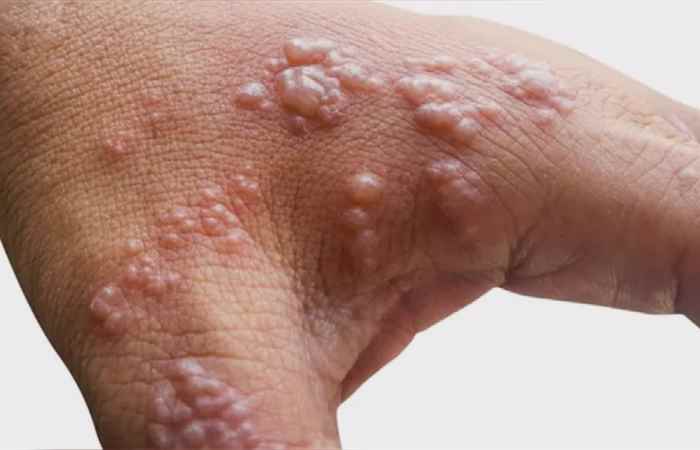 Thời sự trưa (05-10-2022)