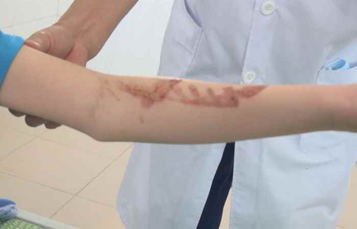 Thời sự trưa 24-11-2020