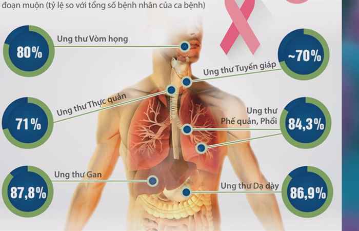 Ung thư mối nguy hiểm đến từ sự thờ ơ (19-04-2021)